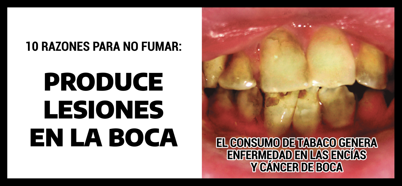 MLB GHW Enfermedad Bucal